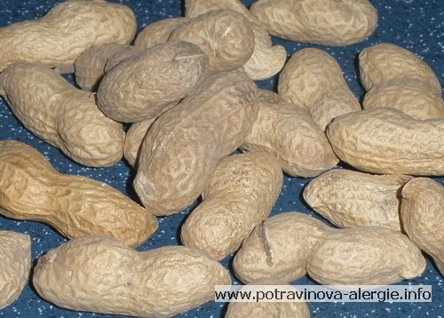 Alergie na arašídy, burské oříšky